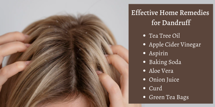 Effective Home Remedies for Dandruff